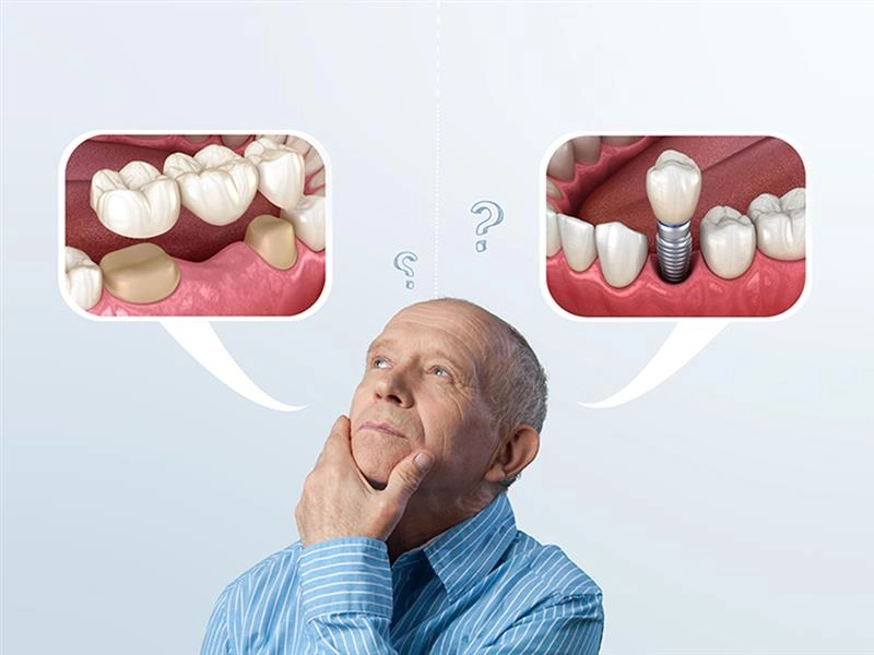 Which Type of Dental Implant is Right for You? (A Human-Sized Guide with Real Indian Costs) 1 Which Type of Dental Implant is Right for You- featured image