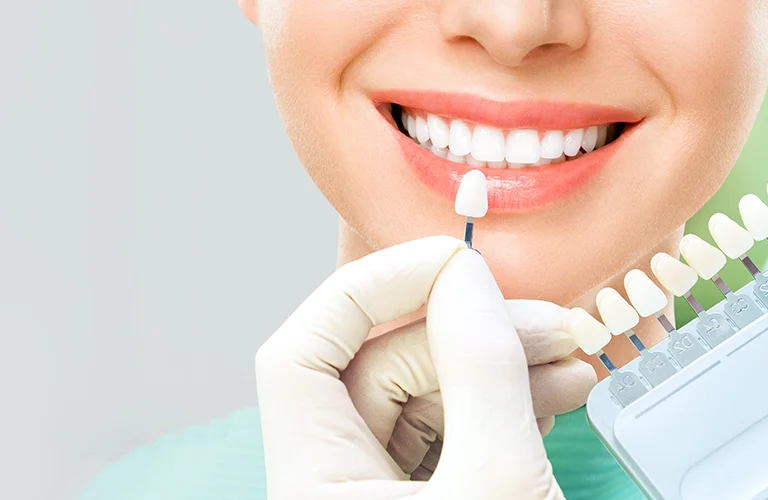 Cosmetic Dentistry at The Tooth Company Jubilee Hills